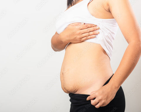 Postpartum in 21 days